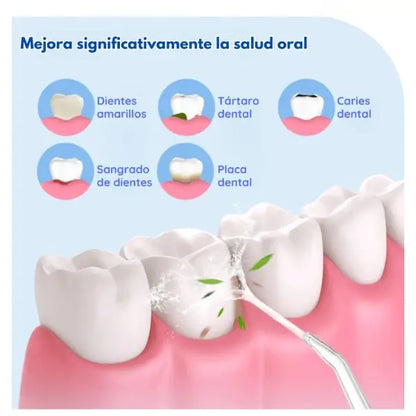 Oral Irrigator